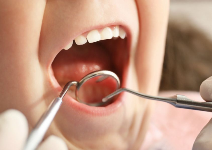 Vijf praktische tips om goed voor de tandjes van je kind te zorgen