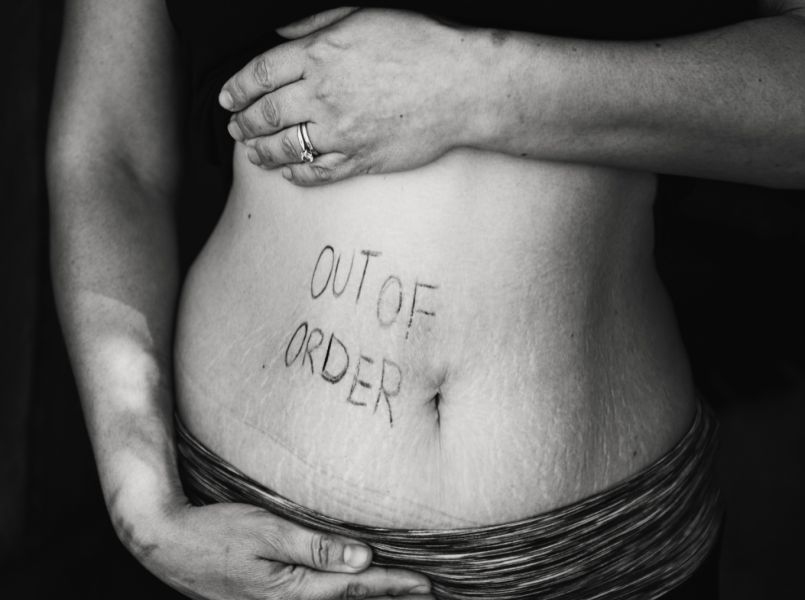 Het normaliseren van een na-de-zwangerschapsbuik: dit model doet het!