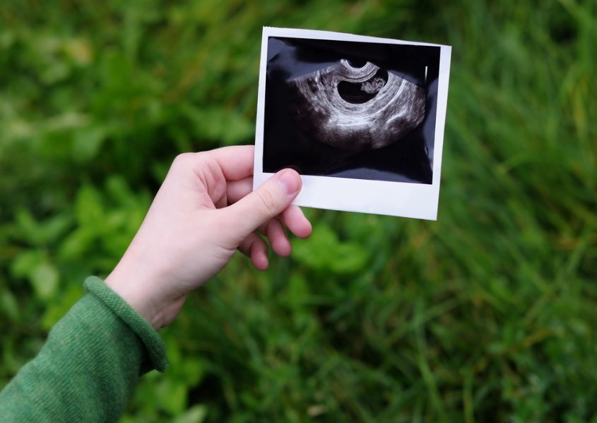 Project baby: de allereerste echo, een bijzonder moment