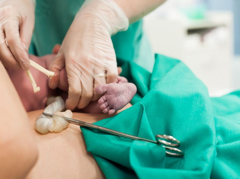 60 seconden wachten met navelstreng doorknippen kan levens redden