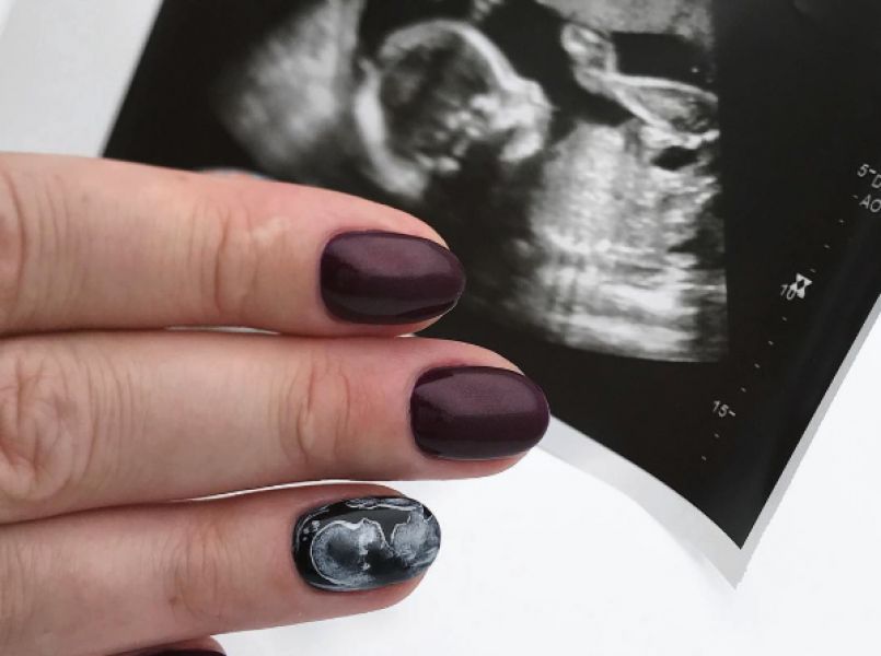 Trend: echo op je nagels